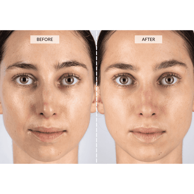 CurrentBody Skin LED Ljusterapi Mask