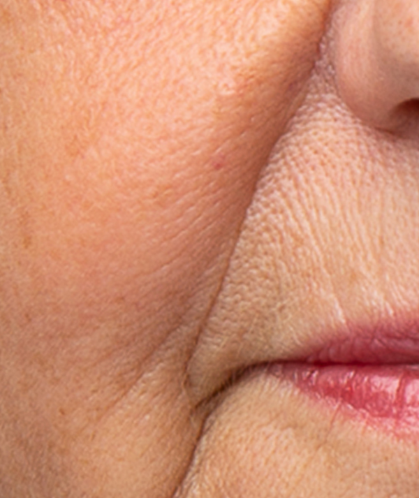 Anti-aging-teknologi