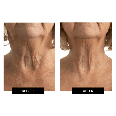 CurrentBody Skin The Neck and Dec Perfector