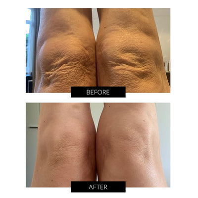 LYMA System Starter Kit + Gratis CurrentBody Skin Hudvård