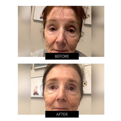 LYMA System Starter Kit + Gratis CurrentBody Skin Hudvård