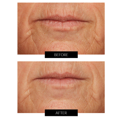 Lancer Caviar Lime Acid Peel with Glycolic Acid 50ml
