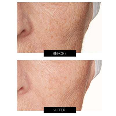 Lancer Skincare Omega Hydrating Oil with Ferment Complex 30ml
