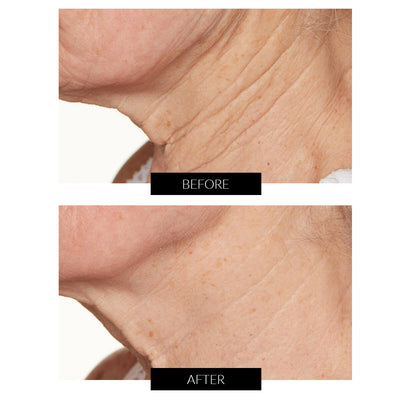 Lancer Skincare Advanced C Radiance Treatment 50ml
