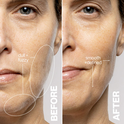 Dermaflash Luxe+ Anti-Ageing, Exfoliation + Peach Fuzz Removal Device